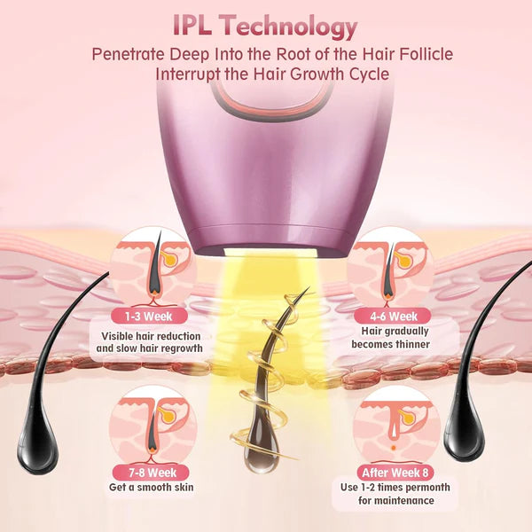 IPL technology illustration showing hair reduction and growth cycle on a pink background