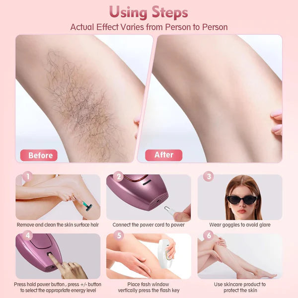 Step-by-step guide on using a hair removal device with 'Before' and 'After' results.
